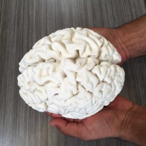 model HM's brain