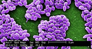 US-NIST_Anthrax-spores