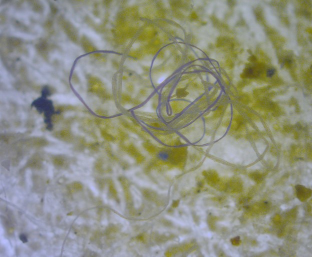 A plastic microfibre in an aquatic environment.